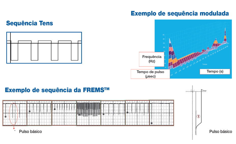 sequencia frems